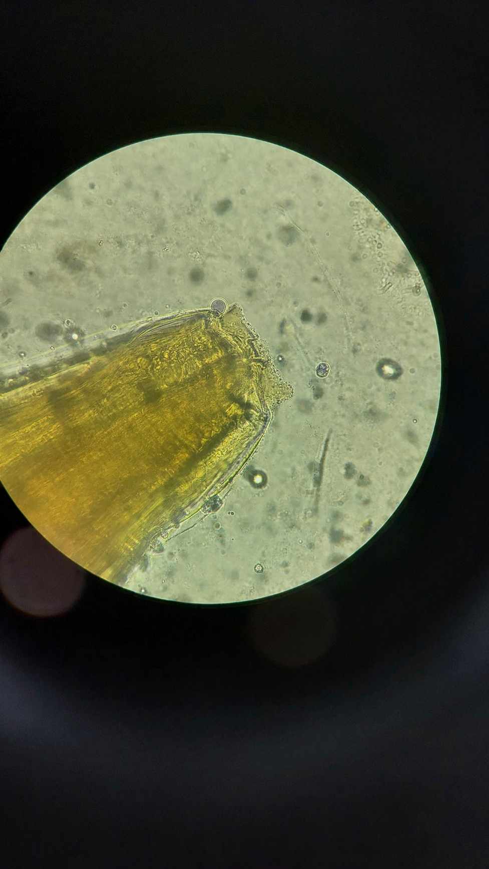 <p>Identify. Give the SN of this worm</p>
