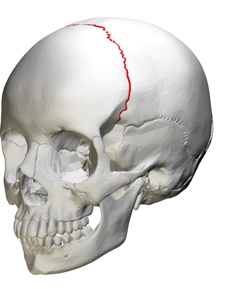 <p>Coronal suture</p>