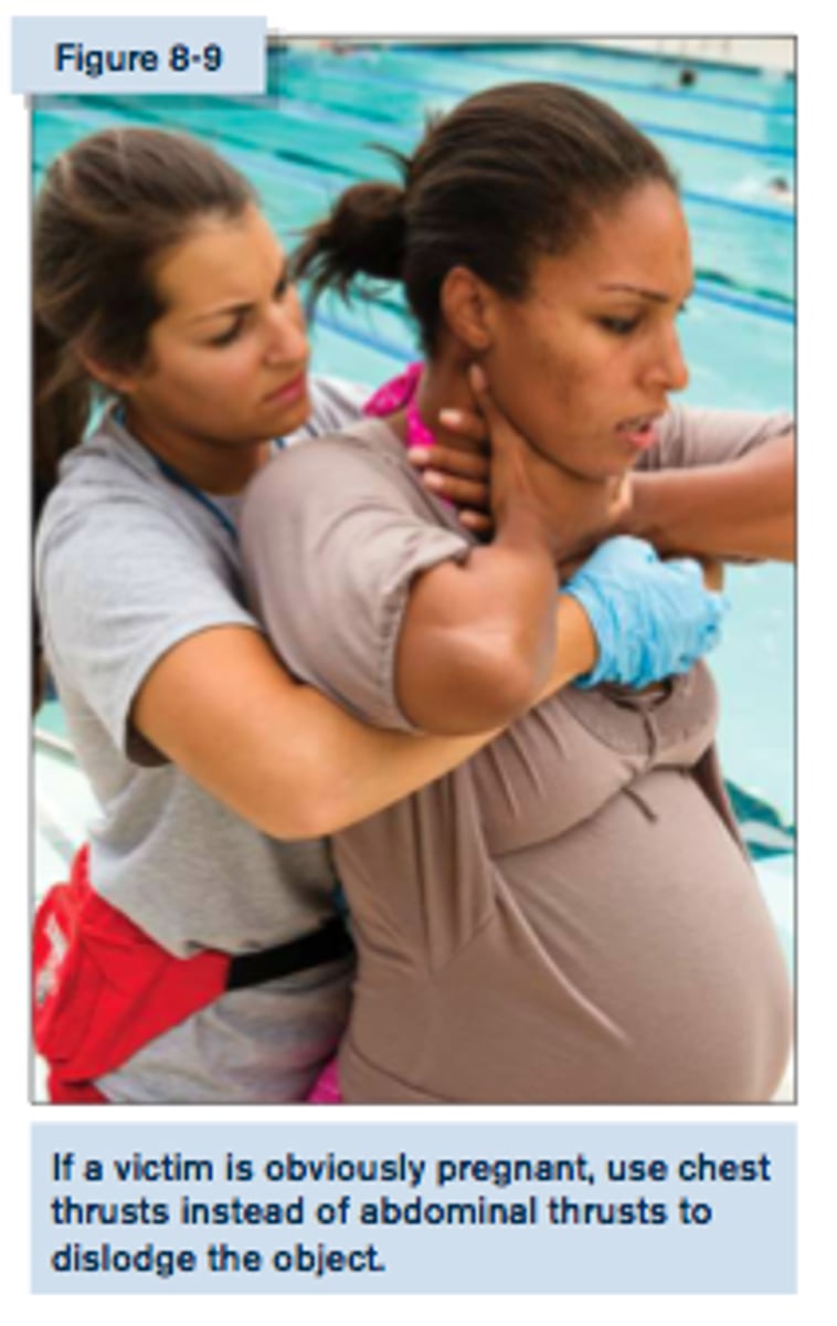 <p>1. stand or kneel behind the person and wrap both of your arms around the person's chest</p><p>2. place your fist in the middle of the person's chest w/ your thumb facing inward, and place your other hand over your fist</p><p>3. give up to 5 chest thrusts by pulling straight back toward you</p>