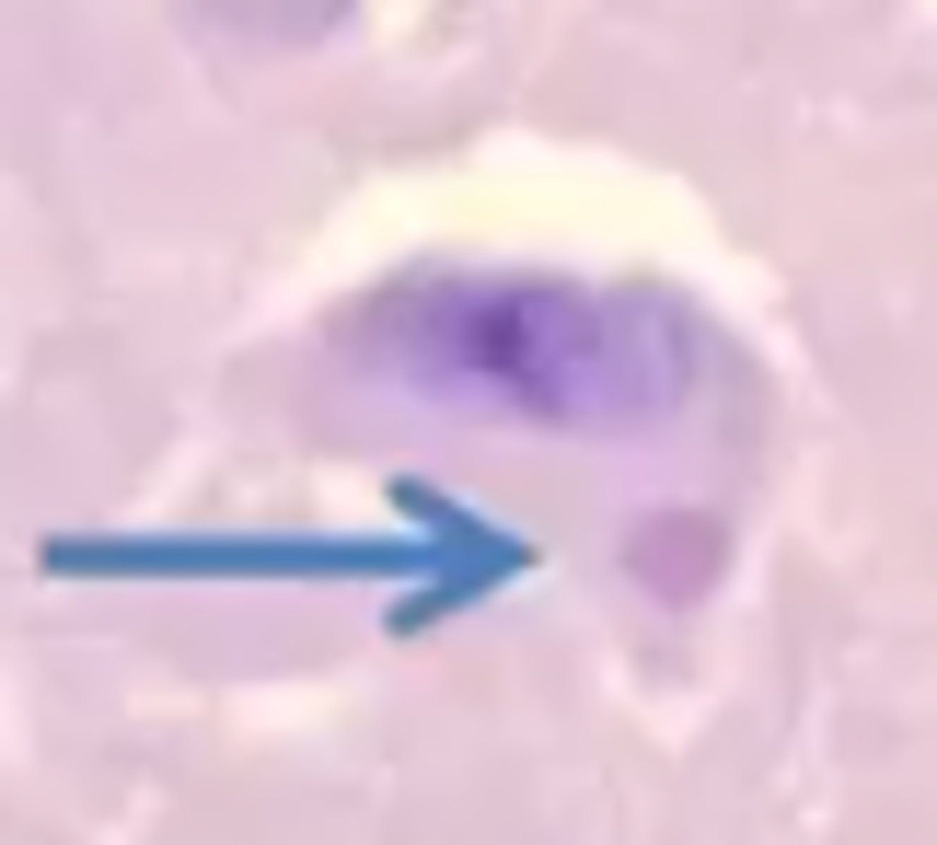 <p>Viral nucleic acid,</p><p>Viral protein, or</p><p>Altered cellular material</p>