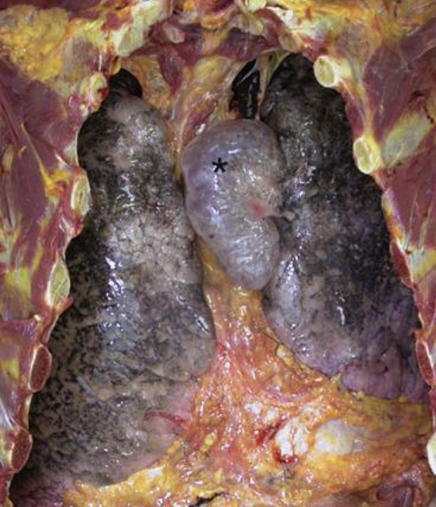 <p>¿Qué es lo que se muestra marcado por el asterisco?</p>