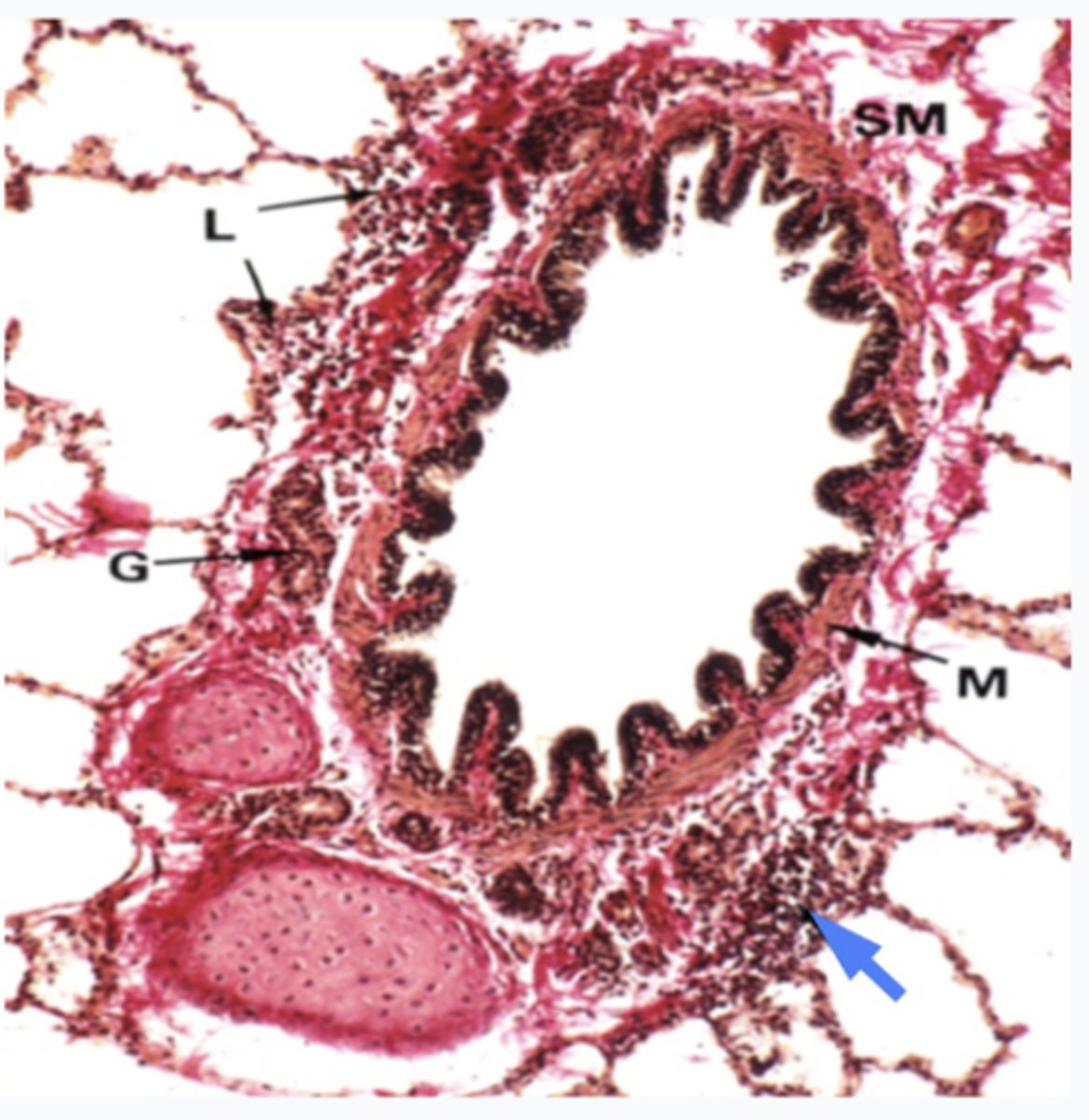 <p>What does the image show?</p>