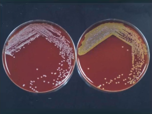 <ul><li><p>staphylococcus epidermidis</p><ul><li><p> skin</p></li></ul></li></ul><ul><li><p>staphylococcus aureus</p><ul><li><p>nose</p></li></ul></li></ul><p></p>