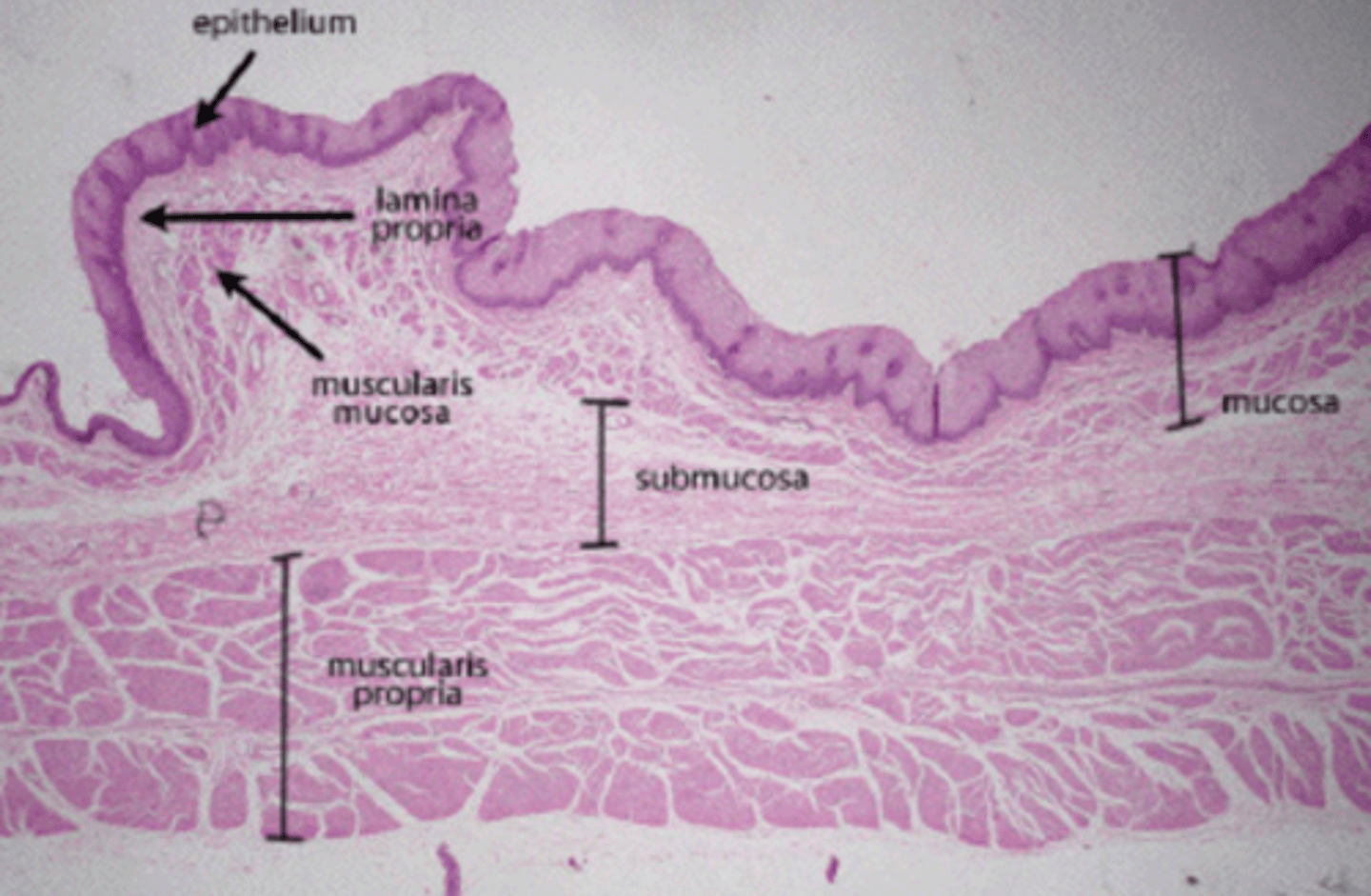 <p>Epithelium</p><p>Lamina propria</p>
