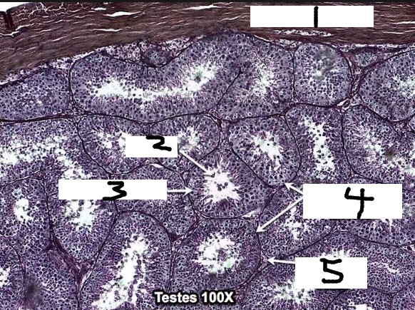 <p>1 testes</p>