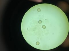 <p>What is the genus species of these tapeworm eggs? Its definitive host is man, and its intermediate host is pigs</p>