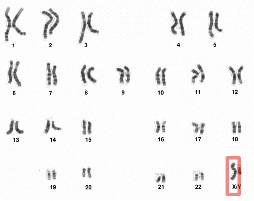 <p>Sex Chromosome </p>