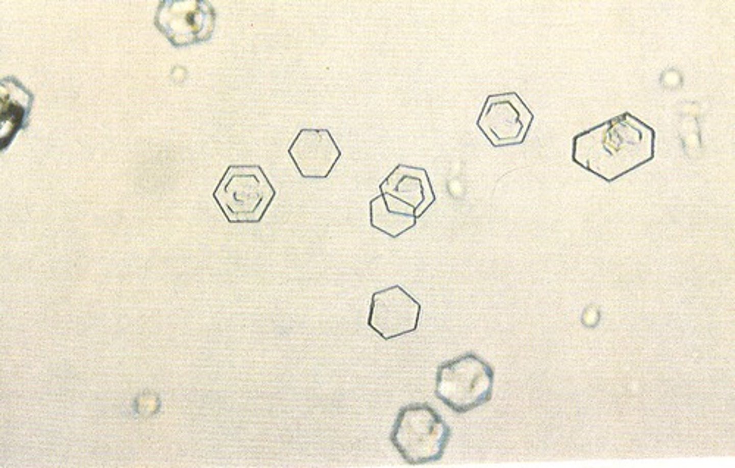 <p>-found in persons who inherit metabolic disorder prevent reabsorption of cystine<br>-Hexagonal, thin and thick plates<br>-Seen in cystinuria: inability to reabsorb cystine<br>-Confirmation by: Cyanide nitroprusside</p>