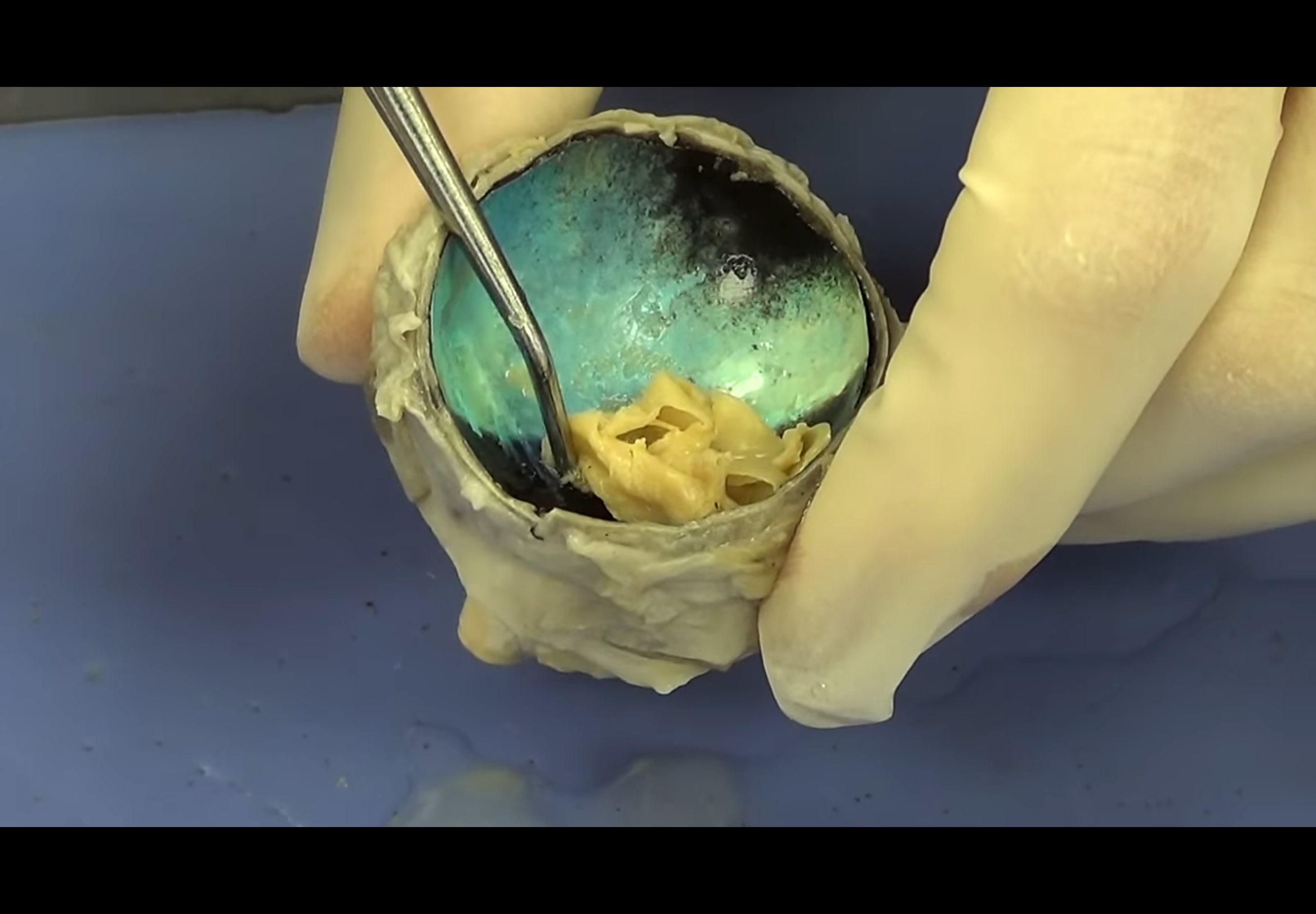 <p>Attachment zone </p>