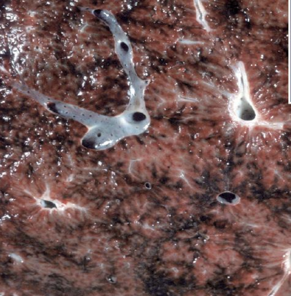 <p>what does the image show?</p>