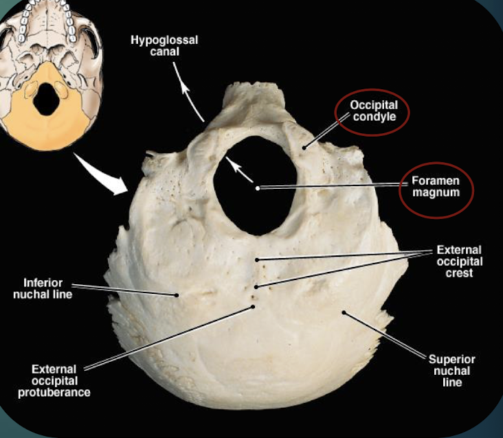 <p>Posterior skull bone; contains foramen magnum &amp; occipital condyles; meets parietals at lambdoid suture.</p>