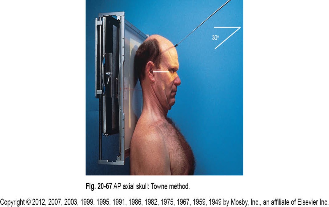 <p>30 </p><p>caudal</p>