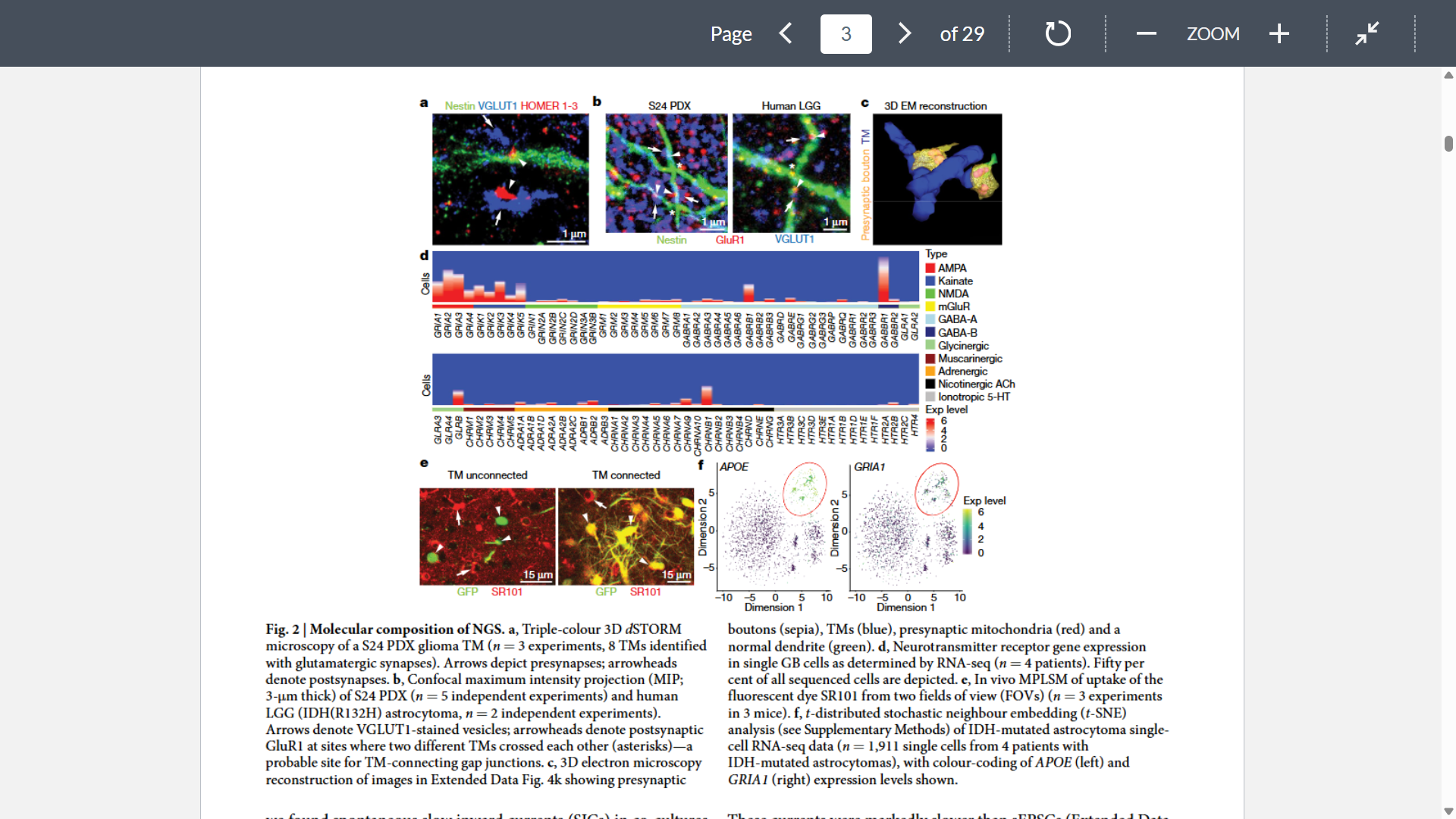 <p>Goal: Show glioma cells express synaptic proteins and AMPA receptors</p><p>Methods: dSTORM micoscopy, confocal imaging, sRNAseq, EM</p><p>Key numbers: Across xenograft models and resected human GB material &gt;80% of AMPAR signals on glioma TMs colocalized with presynaptic signals</p><p>Key takeaway: Glioma cells molecularly organize like neurons at NGS with AMPAR-rich synaptic contacts, especially in TM-connected subpopulations</p>