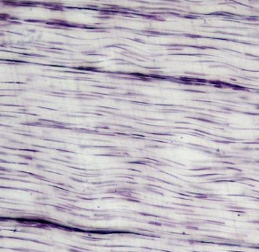 <p>Identify this connective tissue, its location, and its function.</p>