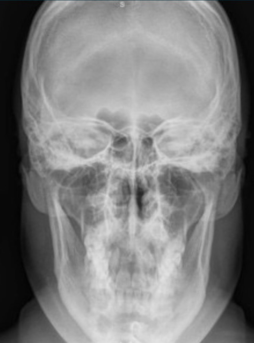 <p>What projection view is this?</p>