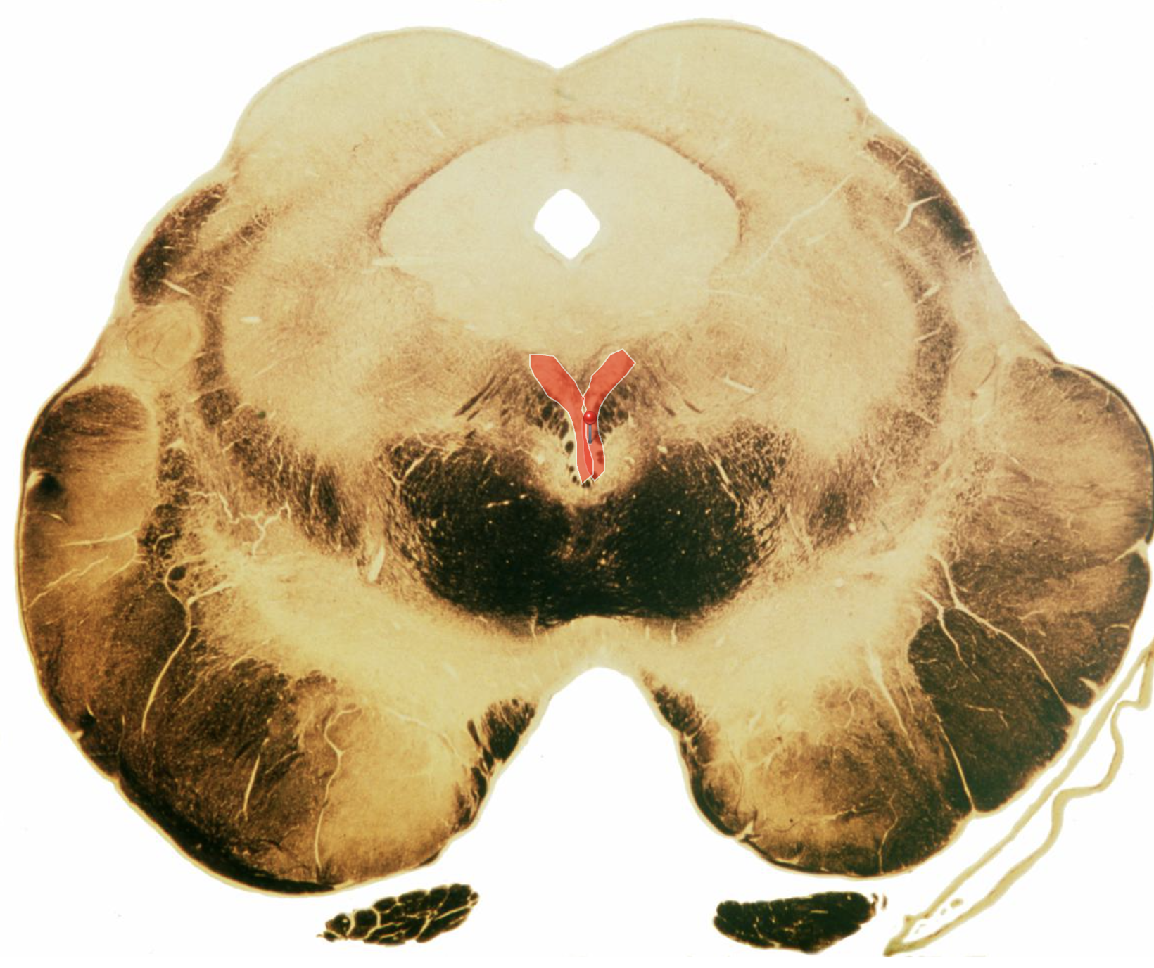 <p>Identify (lock in this ones important)</p>