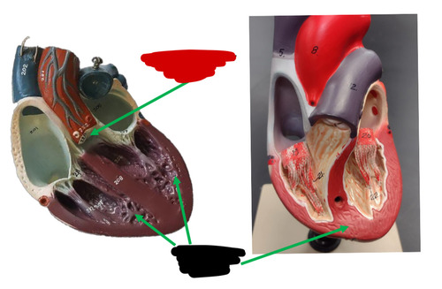 <p>Name this heart valve </p>