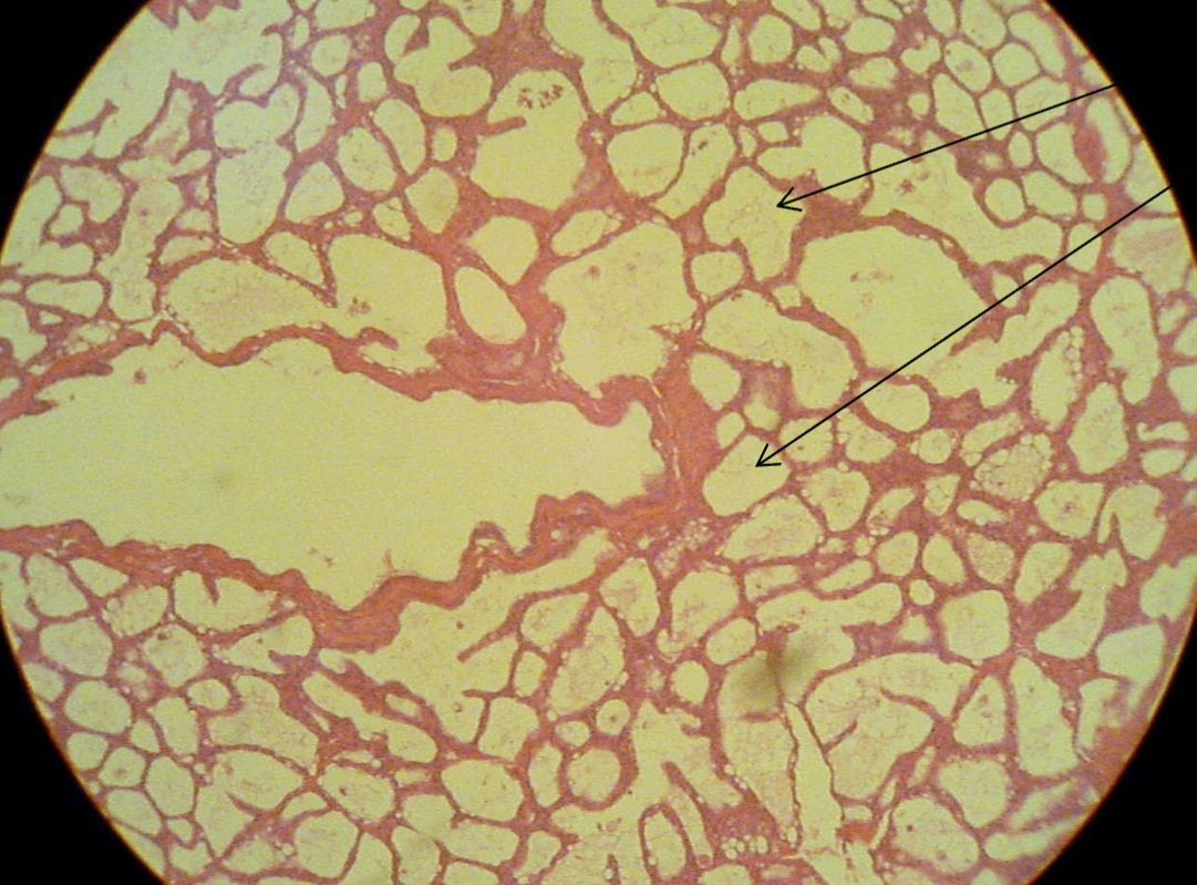 <p>What phase is this mammary tissue undergoing?</p>