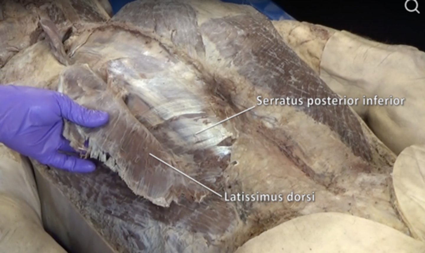 <p>posterior thoracic muscle that supports exhalation by pulling the rib cage down when contracted</p>