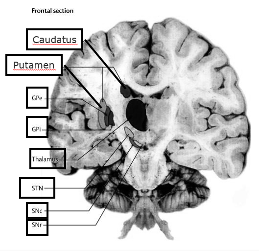 <p>= subcorticale structuren</p><p><strong>Stratium</strong></p><ul><li><p>nucleus accumbens</p></li><li><p>dorsaal striatum</p><ul><li><p>nucleus caudatus</p></li><li><p>putamen</p></li></ul></li></ul><p><strong>Globus pallidus</strong></p><ul><li><p>intern &amp; extern (<strong>Gpi/Gpe</strong>)</p></li></ul><p><strong>Nucleus lentiformis</strong> = putamen + globus pallidus</p><p><strong>Substantia nigra</strong></p><ul><li><p>compacta + reticulata (<strong>SNc/SNr</strong>)</p></li></ul><p><strong>Subthalamische nucleus (STN)</strong></p>