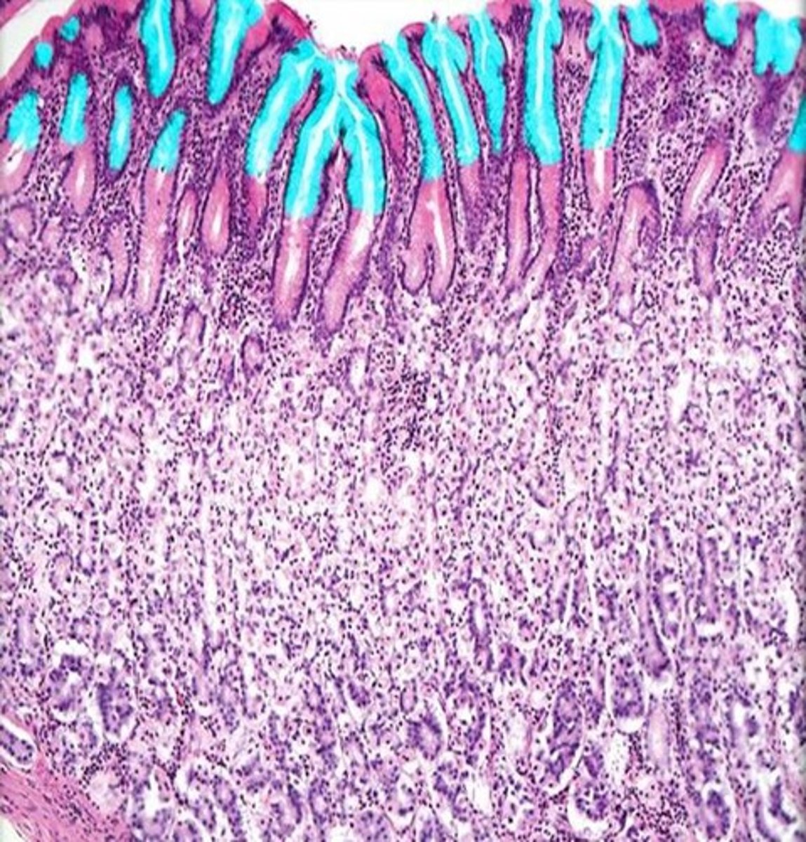 <p>Name these spaces in the stomach mucosa.</p>