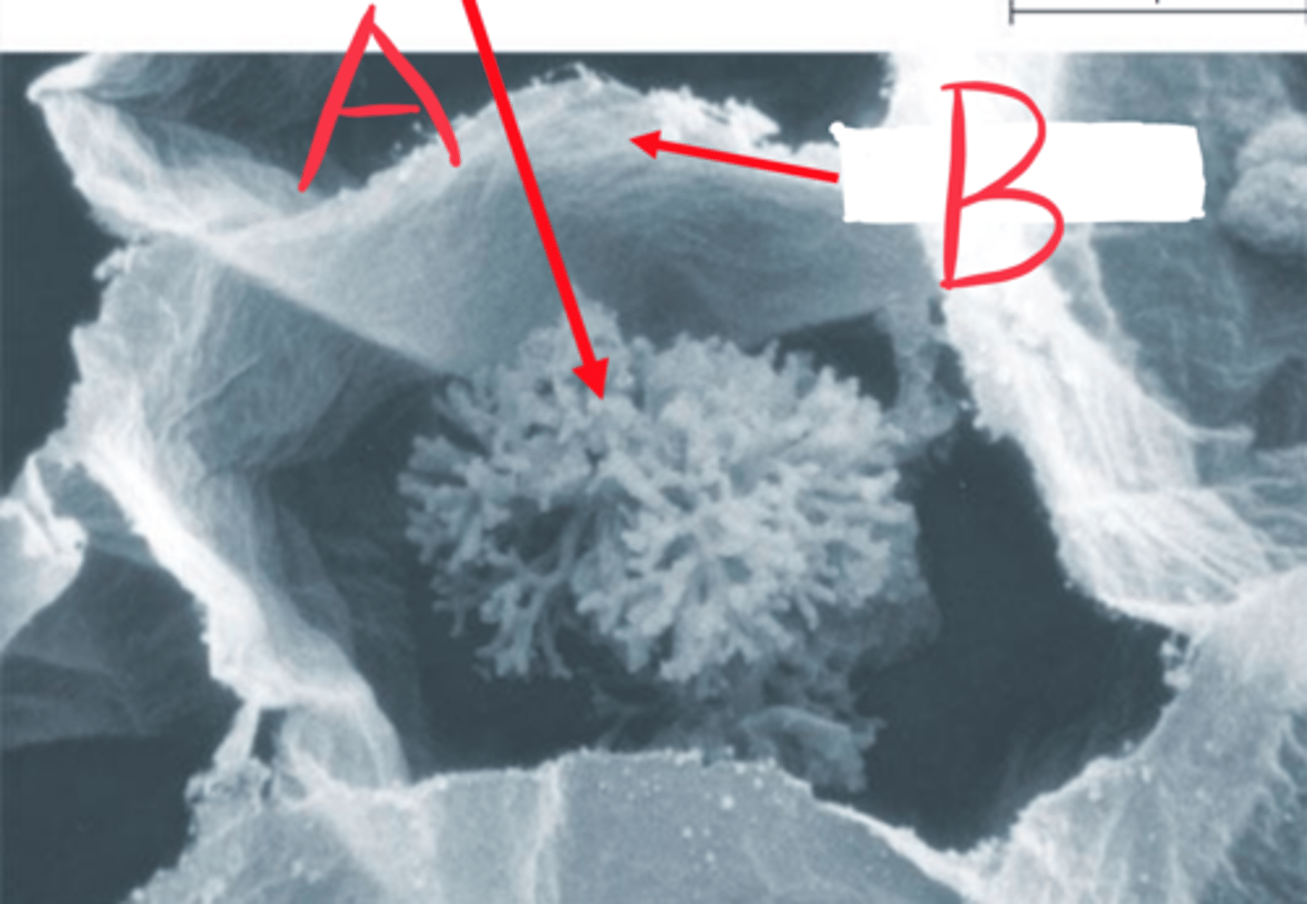 <p>Glomeromycota, specialized parasitic hyphae that invade living cells and secrete digestive enzymes</p>
