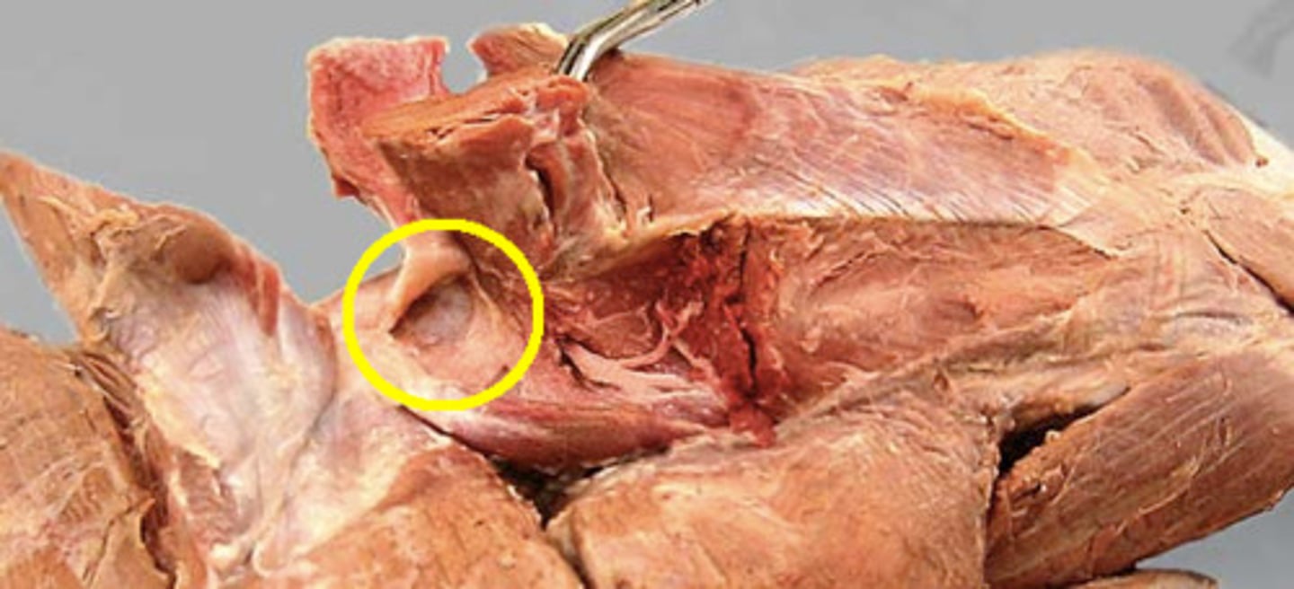 <p>Synovial fluid filled sac that will reduce friction of the muscle tendon as it glides over the humerus</p>