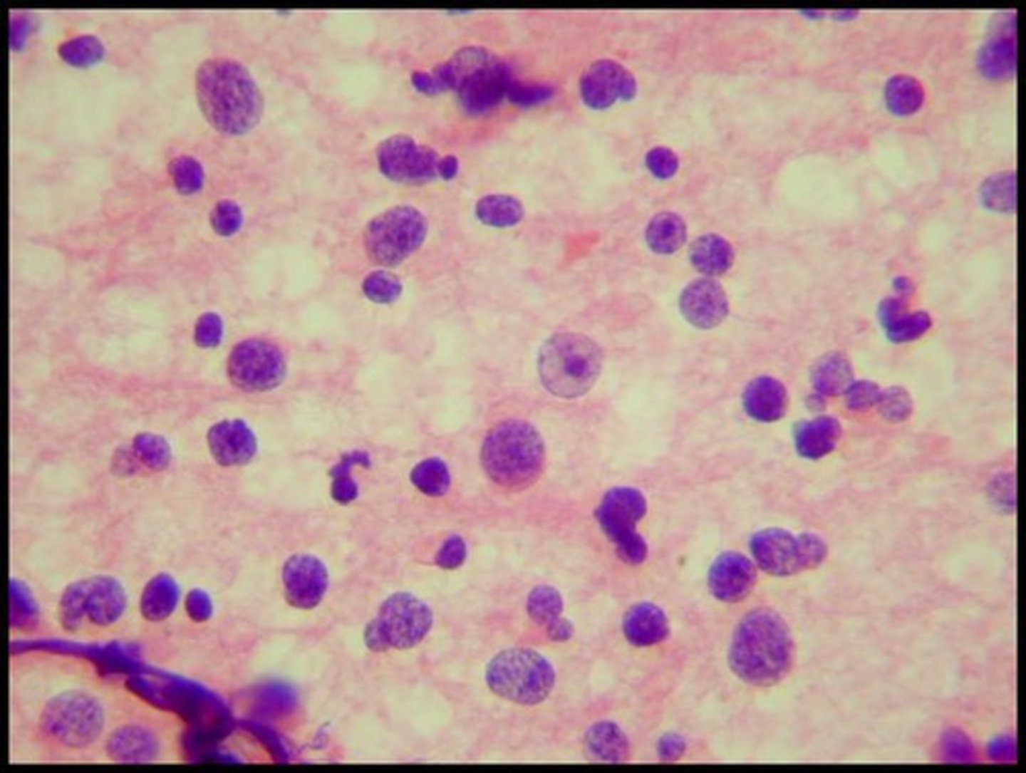 <p>having variation in the size and shape of cells or their nuclei.</p>