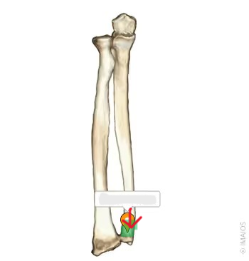 <p>What part of the ulna is this?</p>