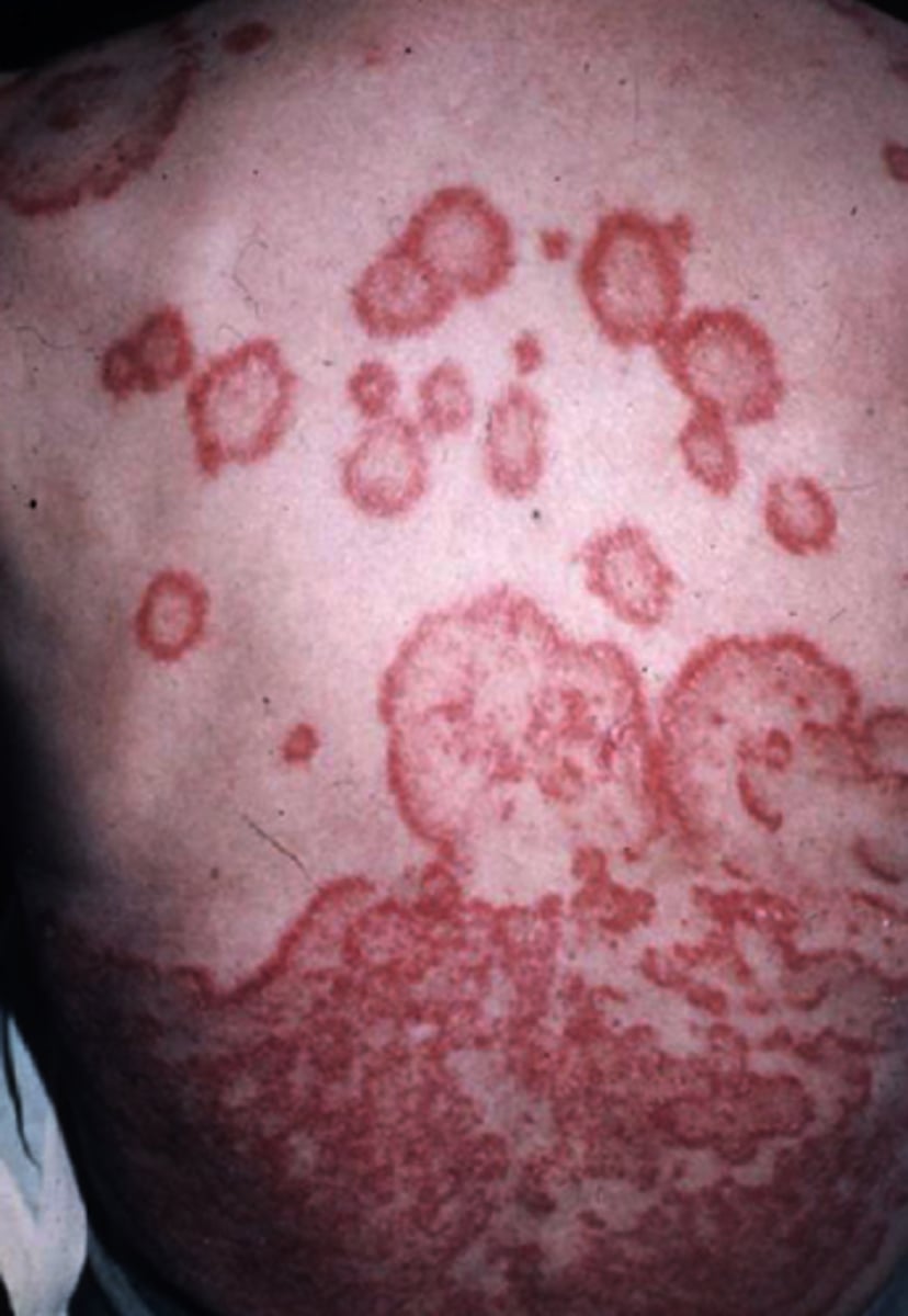 <p>What is the diagnosis?</p>