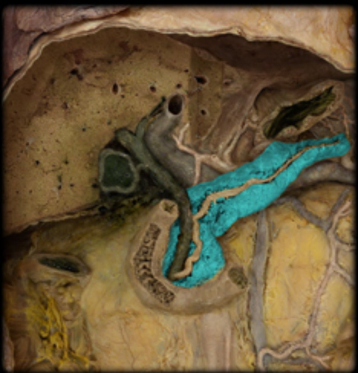 <p>Identify this accessory digestive organ.</p>