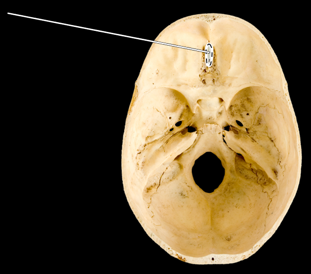 <p>Name the highlighted portion.</p><p>(Skull, superior view of cranial cavity).</p>