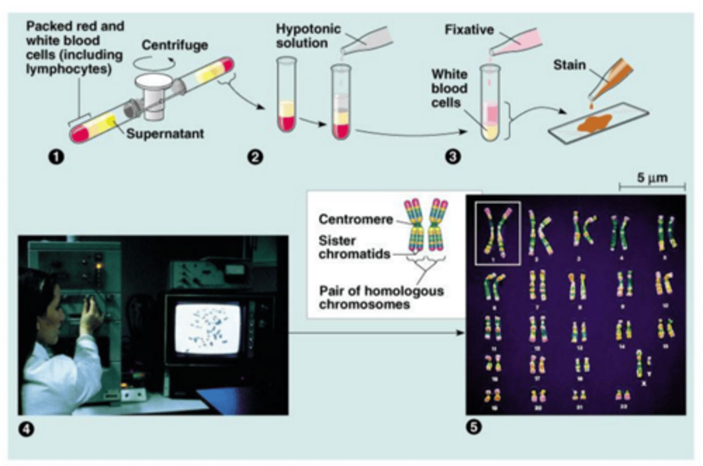 <p>A process in which metaphase chromosomes are stained, ordered, and numbered according to size, arm-length ratio, and banding pattern; used to detect genetic abnormalities; can be performed on a sample of blood, bone marrow, amniotic fluid, or placental tissue</p>