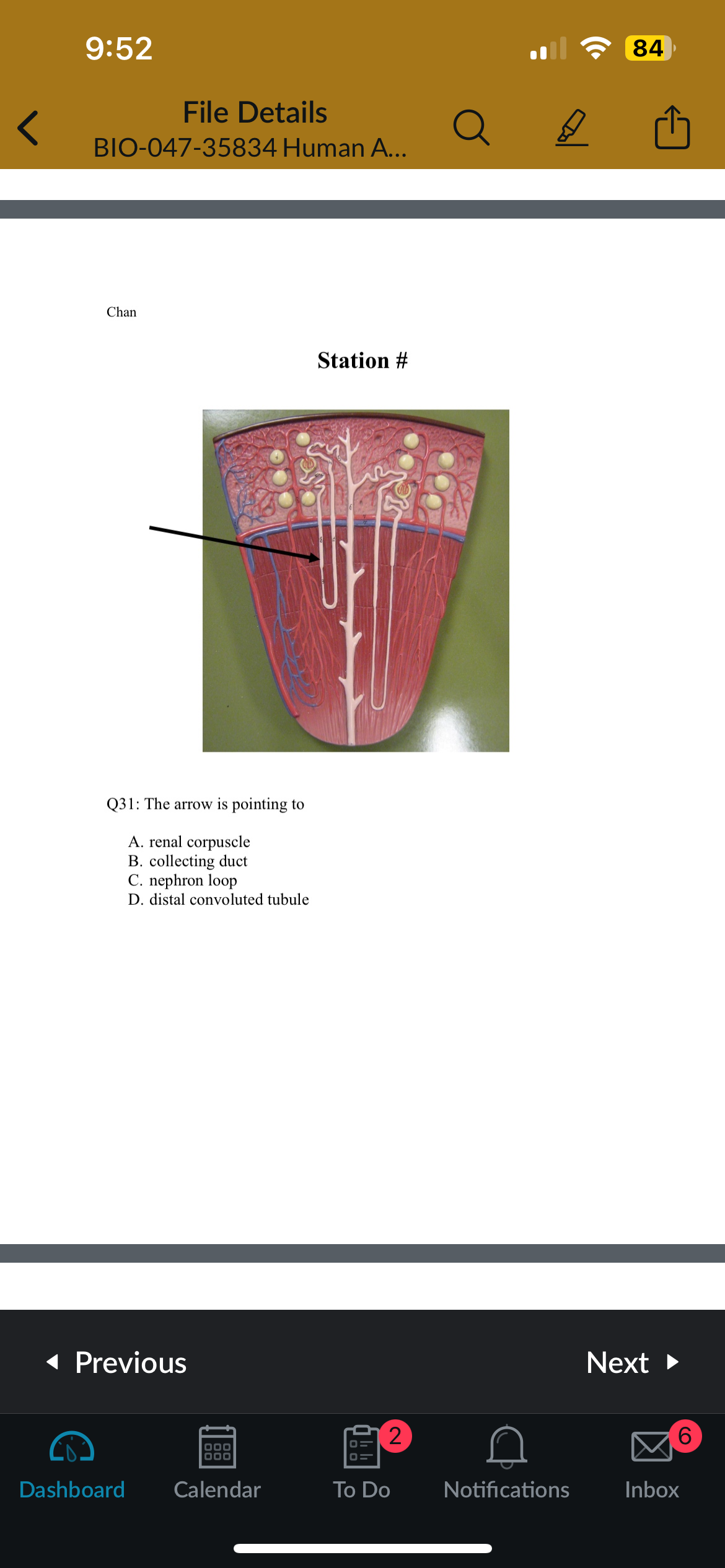 <p>Q31: The arrow is pointing to</p>