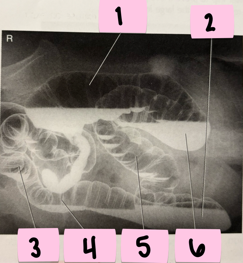 <p>What is 4 pointing to?</p>