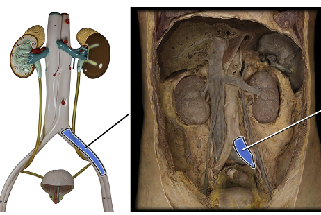 <p>supplies blood to leg</p>