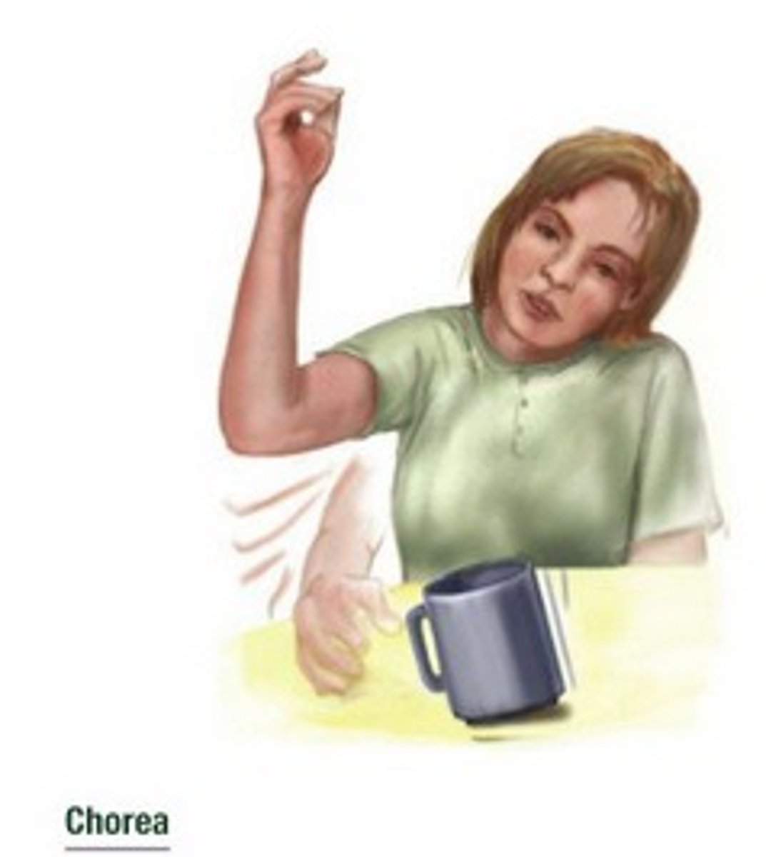 <p>Sudden, rapid, jerky, purposeless movement involving limbs, trunk, or face</p>