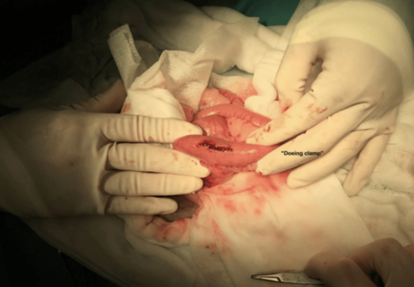<p>what is the name for this operation?</p>
