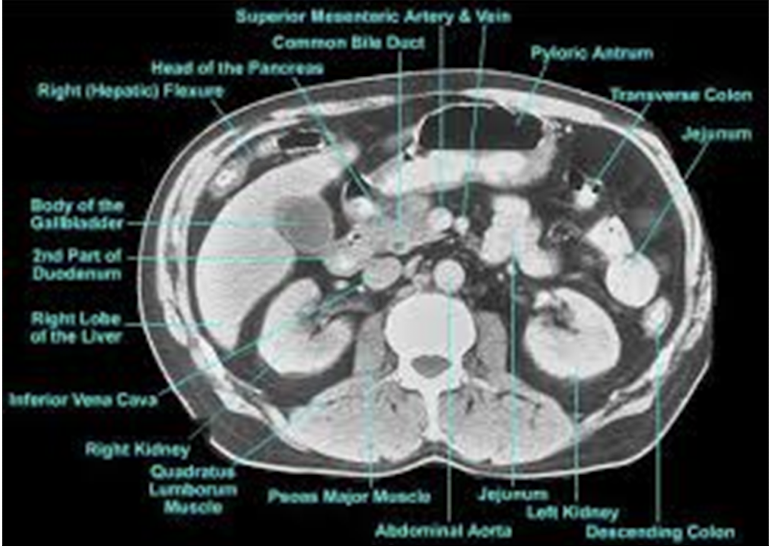 <p>Identify the parts of the GI tract with CT imaging</p>