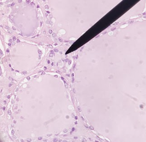 <p>thyroid cells that are responsible for secreting calcitonin </p>