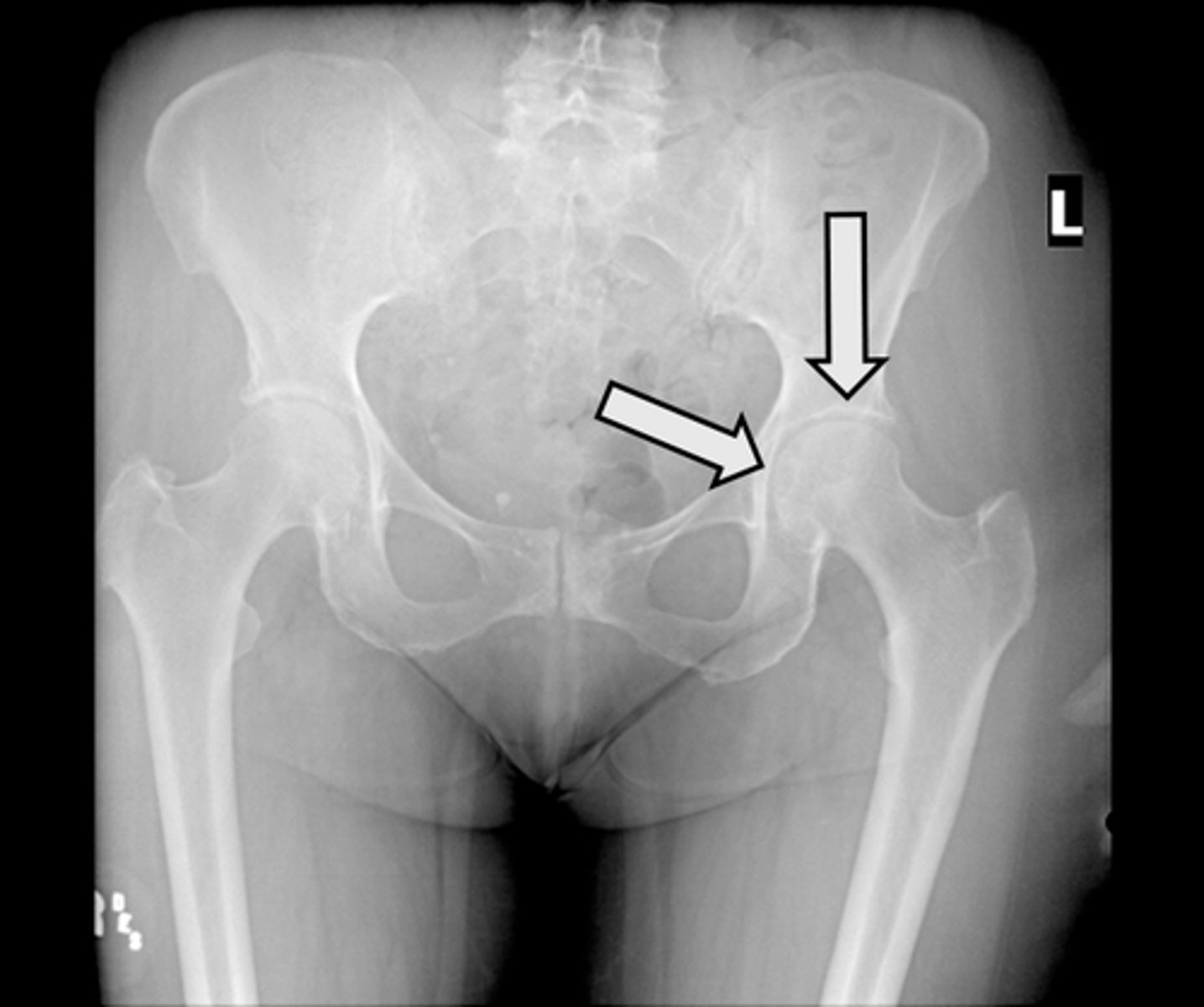 <p>What is indicated in the image?</p>