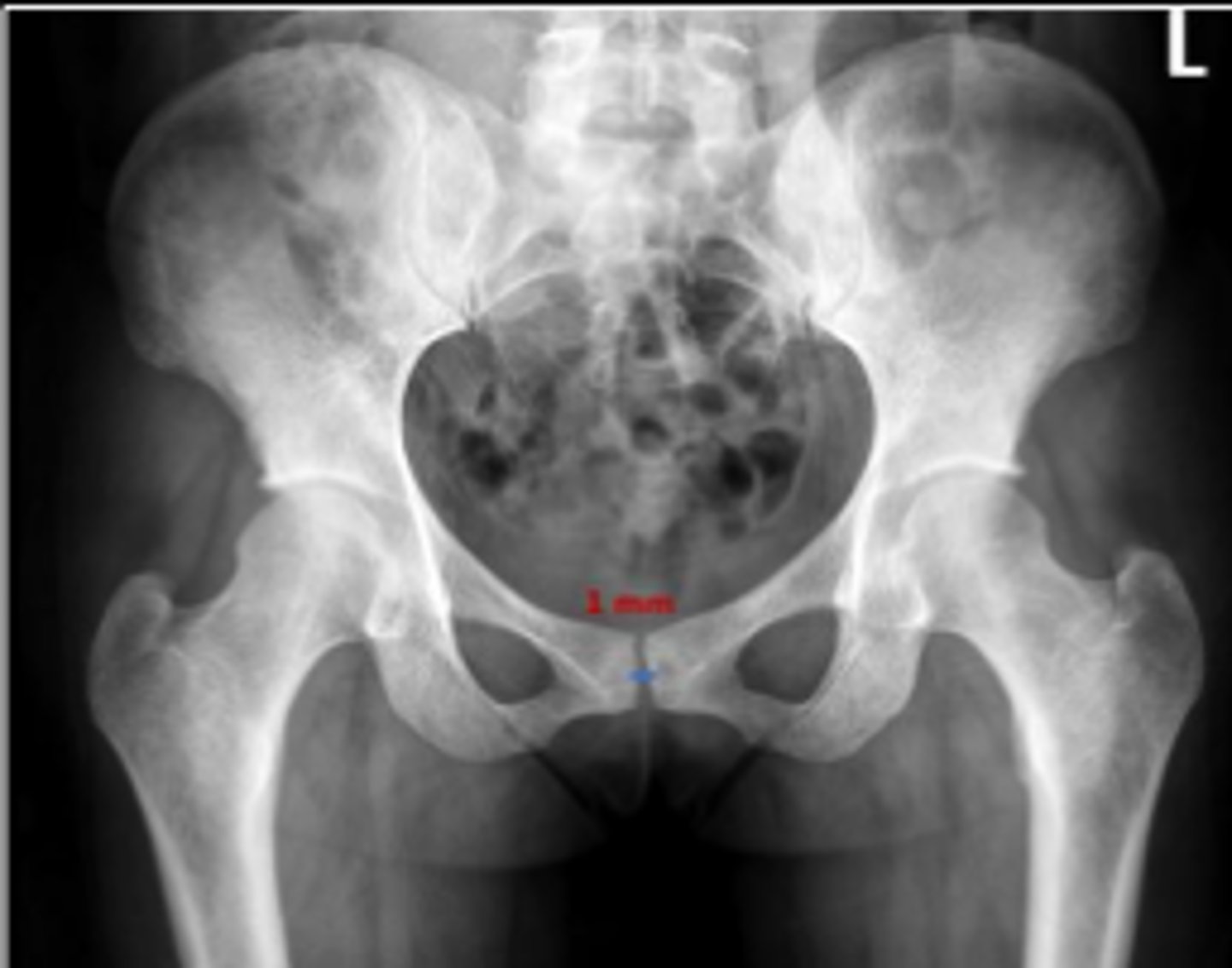 <p>Is the measurement within normal limits?</p>