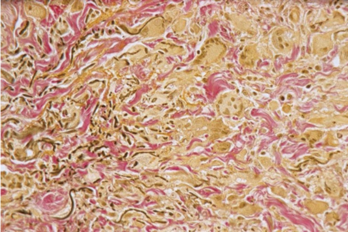 <p>collagen fibers and osteiods: red<br>muscle, fibrin, elastic fibers, reticular fibers, basement membranes: yellow</p>