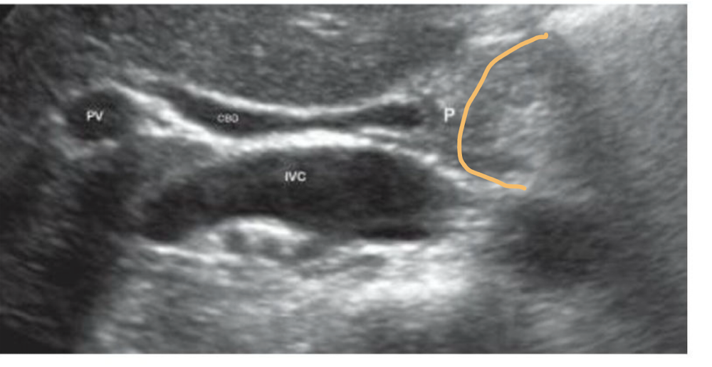 <p>Which is shown in this image?</p>