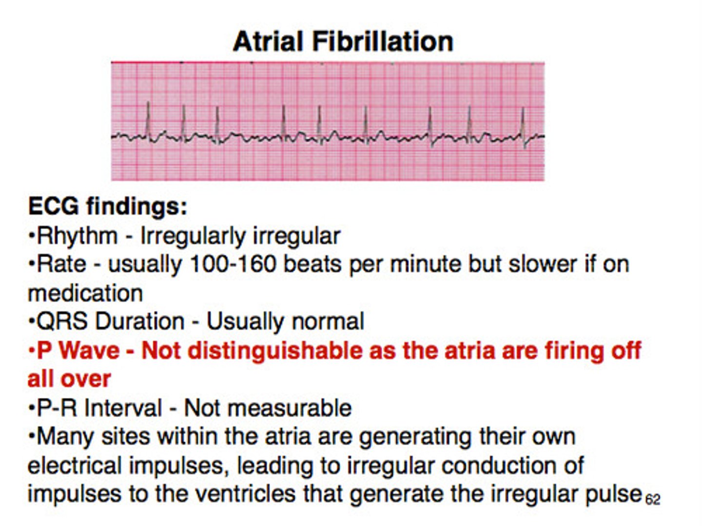 <p>atrial fibrillation</p>
