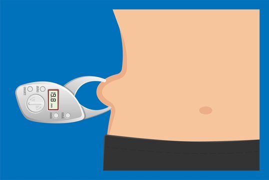 <p>Skinfolds — measurements derived from density measurements</p>