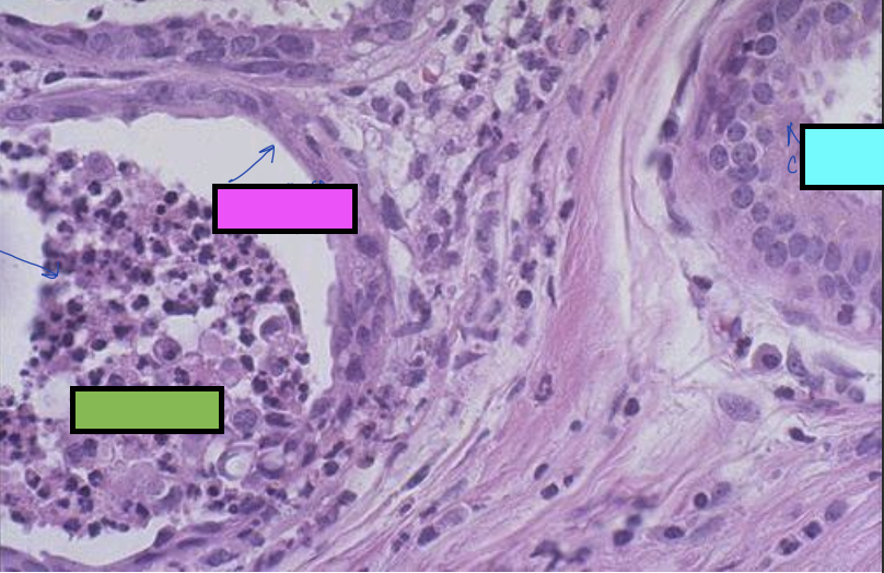 <p>what is the pink box cell showing?</p>