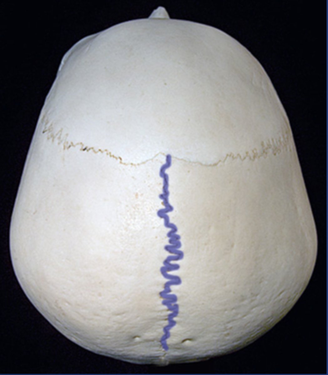 <p>joint connecting parietal bones</p>