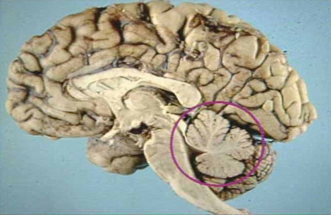 <p>What is in the circle?</p>