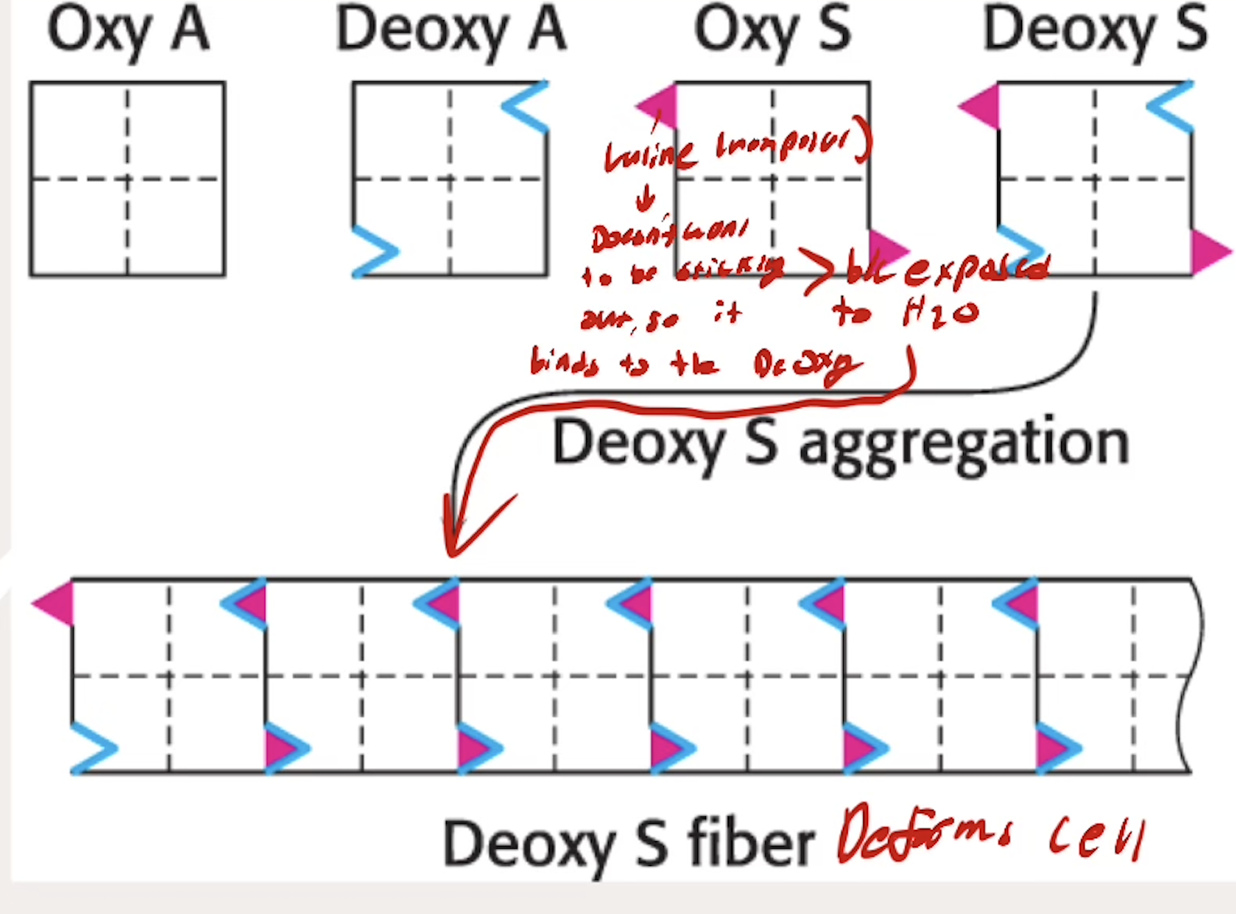 <p>A genetic diseases caused by a Glu6Val mutation to B chains (Glutamine → Valine)</p><ul><li><p>Valine exposed to deoxyHb and interacts with deoxyHb’s that aggregate and deform the red blood cells</p><ul><li><p>Valine doesn’t want to be sticking out since it is nonpolar, wants to be inside something, so it binds to other DeOxy Hb binding sites</p></li></ul></li></ul><p></p>